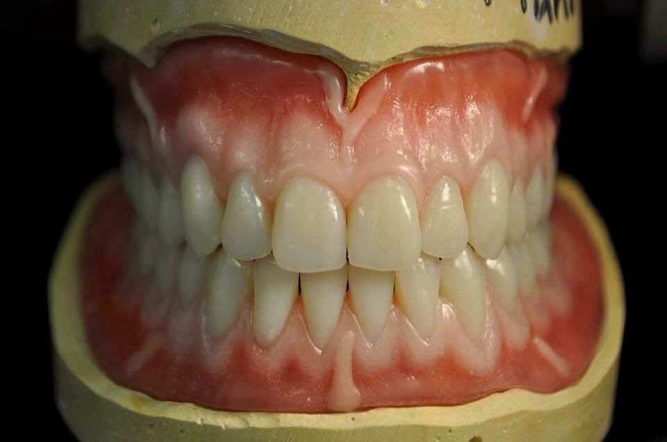 Without Dentures Henning MN 56551